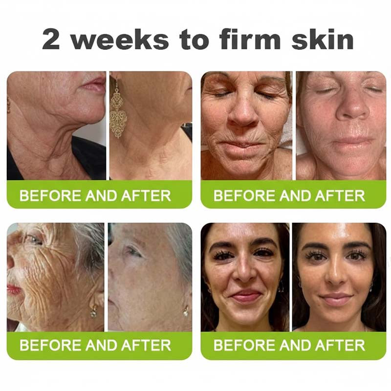 [🔥Last Day 50% OFF] LOVILDS™ Moringa & Retinol Shot - Eraser for Deep Wrinkles, Sagging Jowls & Puffy Eyes