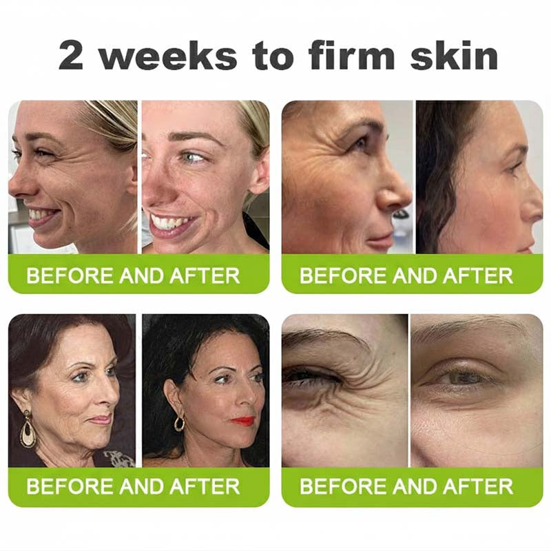 [🔥Last Day 50% OFF] LOVILDS™ Moringa & Retinol Shot - Eraser for Deep Wrinkles, Sagging Jowls & Puffy Eyes