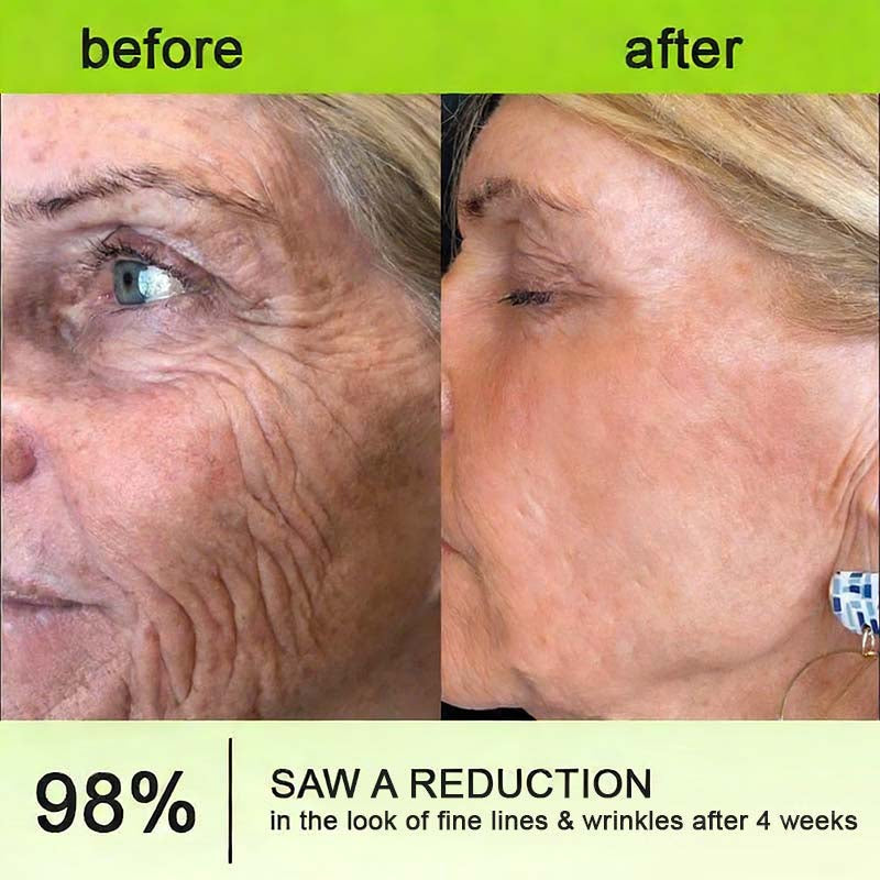 [🔥Last Day 50% OFF] LOVILDS™ Moringa & Retinol Shot - Eraser for Deep Wrinkles, Sagging Jowls & Puffy Eyes