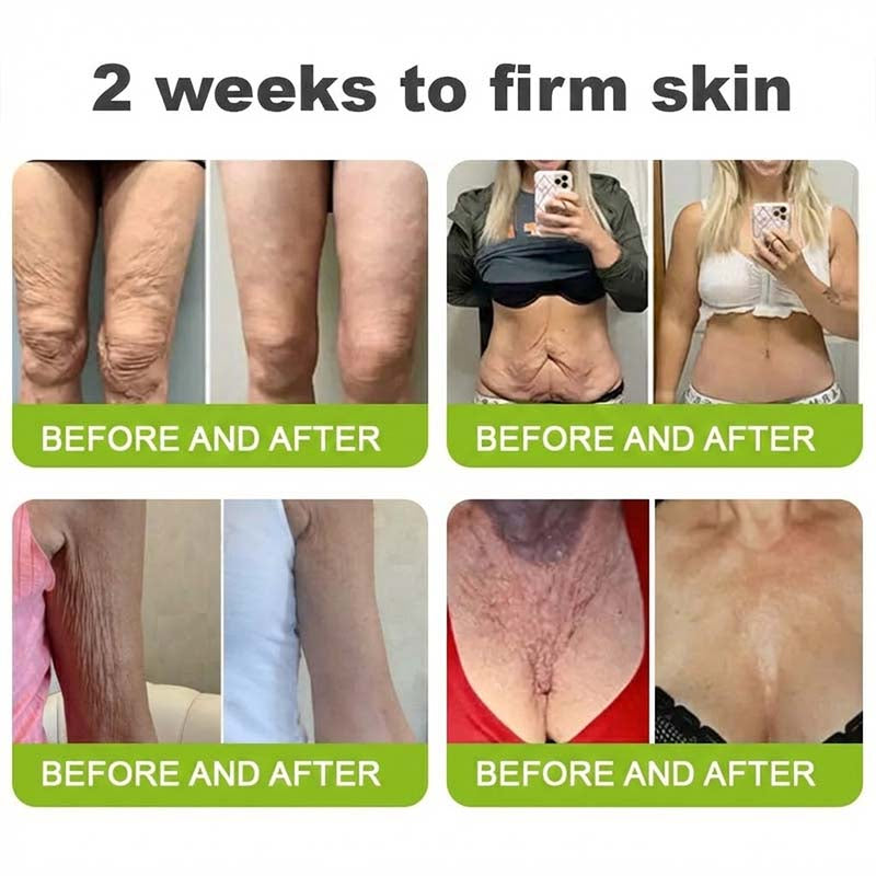 [🔥Last Day 50% OFF] LOVILDS™ Moringa & Retinol Shot - Eraser for Deep Wrinkles, Sagging Jowls & Puffy Eyes