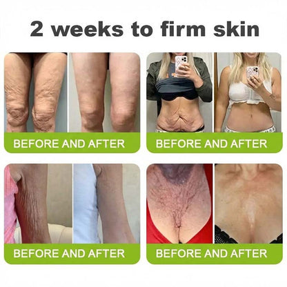 [🔥Last Day 50% OFF] LOVILDS™ Moringa & Retinol Shot - Eraser for Deep Wrinkles, Sagging Jowls & Puffy Eyes