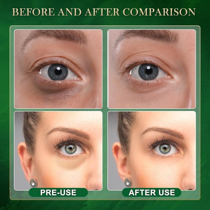 🌙 Retinol Gel Eye Masks — 49% OFF — ✨ Triple-Action Eye Revitalization — Instantly Depuffs, Restores Radiance!