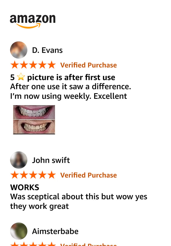 V34 Whitening Strips – Peroxide-Free, Color-Correcting Teeth Whitening in 30 Minutes